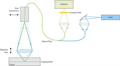 Confocal laser imaging in neurosurgery: A comprehensive review of sodium fluorescein-based CONVIVO preclinical and clinical applications